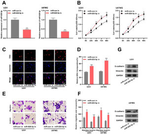 The inhibition of miR-628-5p expression promotes the proliferation, migration, invasion, and EMT of glioma cells. A, miRNA inhibitor control (miR-con in) and miR-628-5p inhibitor (miR-628-5p in) were transfected into U251 and U87MG cells to construct models of the inhibition of miR-628-5p expression, and the transfection efficiency was detected using qRT-PCR. (B–D) The proliferation of U251 and U87MG cells was detected using CCK-8 (B) and EdU assays (C-D). (E-F) Transwell assay was used to detect the migration and invasion of U251 (E) and U87MG cells (F). G, Western blot assay was used to detect the expression of EMT-related proteins E-cadherin and vimentin in U251 and U87MG cells. The experiments were repeated three times, and the average was recorded. *p < 0.05, **p < 0.01, and ***p < 0.001.
