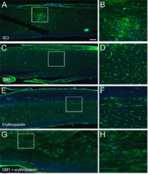 (A) Myelin Basic Protein (MBP, green) immunofluorescence counterstained with 4′, 6-Diamidino-2-Phenylindole (DAPI, blue) in longitudinal spinal cord sections of mice submitted to spinal cord injury (control group). (B) Microphotograph of the spinal cord of an animal in control group labeled with MBP. (C) Digital zoom of the area selected in A. (D) Microphotograph of the spinal cord of an animal with SCI treated with GM1. (E) Digital zoom of the area selected in C. (F) Microphotograph of the spinal cord of an animal with SCI treated with erythropoietin. (G) Digital zoom of the area selected in E. (H) Microphotograph of the spinal cord of an animal with SCI treated with a GM1 + erythropoietin combination.