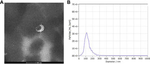 Identification of plasma exosomes. (A) Exosomes were photographed by transmission electron microscopy. (B) Concentration and diameter of isolated exosomes as detected by Nanoparticle Tracking Analysis (NTA).