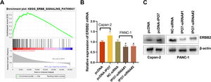 The regulatory effect of IPO7 on the ERBB pathway. (A) GSEA showed that ERBB signal pathway was related with IPO7 in PC. (B‒C) qRT-PCR and Western blotting showed that ERBB2 expression was up-regulated in pcDNA-IPO7 group and down-regulated in IPO7-siRNA#1 and IPO7-siRNA#2 group. All of the experiments were performed in triplicate (*p < 0.05).