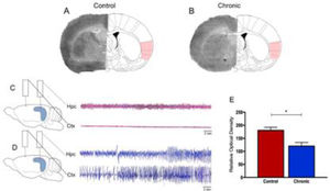 Representative 14C-2DG autoradiographs in (A) control rats and (B) rats with epilepsy. Electroencephalograph traces were obtained from control animals (C) and animals with epilepsy (D). Graphic representation of basal levels of cerebral energy metabolism in the control and experimental animals (E).