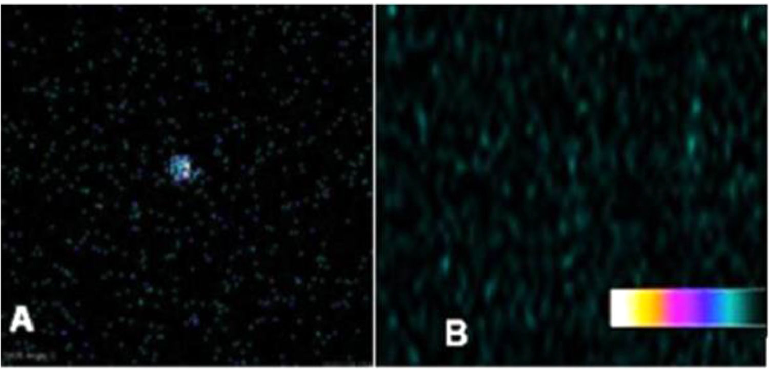Fresh Look at Rat Thyroid Graft Transplantation After Cryopreservation With