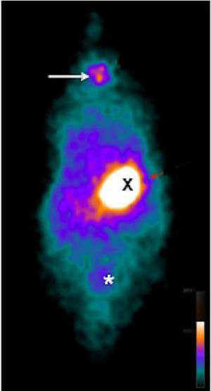 Whole body planar 99mTc scintigraphy in CG of rats. 99mTc biodistribution on the 14th day revealing higher uptake in thyroid (arrow), stomach (X) and bladder (*).