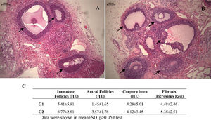 Photomicrographs of frozen-thawed rat ovarian autografts treated with culture medium (A) or adipose tissue-derived stem cells (B). In (C) follicular density and fibrosis quantification. Arrows shows viable ovarian follicles (HE 100 ×).