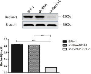 Efficiency of Beclin-1 silencing detected by Western blot. Data are representative of the relative expression of proteins that was normalized by β-actin.