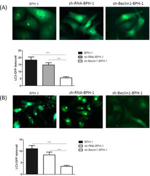 Silencing of Beclin-1 decreased the number of autophagosomes in BPH-1 cells. GFP-LC3 cleavage assay was carried out to monitor the autophagic flux. The expression of GFP-LC3 puncta was observed under different experimental conditions. (A) AD condition. (B) AD+AI condition.