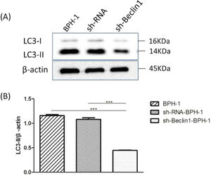 Silencing of Beclin-1 diminished the expression of LC3-II in BPH-1 cells. Cells in each group were cultured for 24 h under the AD+AI condition, and the expression of LC3 protein in each group was examined. (A) Protein bands of LC3 and β-actin. (B) The relative expression of LC3-II proteins that was normalized by β-actin.