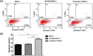 Silencing of Beclin-1 enhanced the apoptotic rate of BPH-1 cells. Cells in each group were cultured for 24 h under the AD+AI condition. (A) The apoptotic rate of cells from each group was detected by flow cytometry (Annexin V-APC/7-AAD). (B) The percentage of apoptotic cells was shown as the sum of annexin V-positive and annexin V/7-AAD double-positive cells.