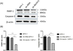 Silencing of Beclin-1 affected the activation of PARP-1 and Caspase-3 in BPH-1 cells. Cells in each group were cultured for 24 h under the AD+AI condition, and the expression of PARP-1and caspase-3 in each group was examined. (A) Protein samples of each group were detected by Western blot using anti-PARP-1 and anti-caspase-3 antibodies. (B) The relative expressions of PARP-1 and caspase-3 that were normalized by β-actin.