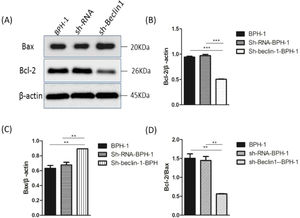 Silencing of Beclin-1 elevated Bax protein and lessen Bcl-2 protein expression BPH-1 cells. Cells in each group were cultured for 24 h under the AD+AI condition, and the expressions of Bax and Bcl-2 in each group were examined. (A) Protein samples were detected by Western blot using anti-Bax or anti-Bcl-2 antibodies. (B) The relative expressions of Bax and Bcl-2 proteins that were normalized by β-actin.