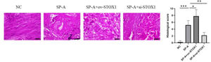 SP-A induced pathological damage to placenta through promoting STOX1. H&E staining images of placentas from NC group, SP-A group, SP-A+ov-STOX1 group and SP-A+si-STOX1 group (n = 6, Scale bar: 100 μm).