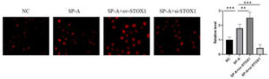 SP-A promoted ROS production through promoting STOX1 in placenta. Images of intracellular ROS production measured by CM-H2DCFDA in placenta from NC group, SP-A group, SP-A+ov-STOX1 group and SP-A+si-STOX1 group (n = 6).