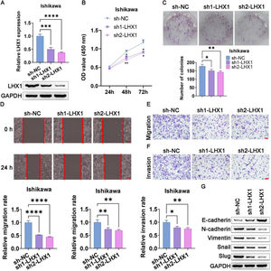 LHX1 knockdown suppresses UCEC cell migration, proliferation, invasion, and EMT induction. (A) LHX1 expression was markedly reduced in RT-qPCR and Western blot assays following sh1-LHX1/sh2-LHX1 transfection. (B) The CCK-8 assay was used to assess cellular proliferation. (C) The colony formation capability of Ishikawa cells was reduced following LHX1 knockdown relative to sh-NC transfection. (D) Ishikawa cell migration decreased in the wound healing assay following LHX1 knockdown (×100; scale bar, 100 μm). (E) Cellular migration and (F) invasion were analyzed and quantified. (G) LHX1 knockdown enhanced E-cadherin expression, while reduced the expression levels of Snail, Slug, Vimentin, and N-cadherin. Results are expressed as mean ± SD; *p < 0.05, **p < 0.01, ***p < 0.001. Data are representative of three independent experiments.