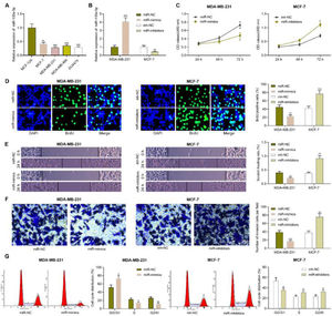 Impacts of miR-135a-5p on the proliferation, migration, invasion and cell cycle progression of BC cell. (A) The expression of miR-135a-5p in immortalized mammary epithelial cells and BC cell lines was detected by qRT-PCR. (B) miR-NC, miR-mimics and inh-NC, and miR-inhibitors were transfected into MDA-MB-231 cells and MCF-7 cells, respectively, and the transfection efficiency was detected by qRT-PCR. (C) After transfection, MDA-MB-231 and MCF-7 cells were tested for the viability by CCK-8 assay. (D) After transfection, the proliferation of MDA-MB-231 and MCF-7 cells was detected by BrdU method. (E, F) Changes in the migration and invasion abilities of MDA-MB-231 and MCF-7 cells after transfection were detected by wound healing assay and Transwell assay. (G) Changes in the cell cycle distribution of MDA-MB-231 and MCF-7 cells were detected by flow cytometry after transfection. * p < 0.05, ** p < 0.01, and *** p < 0.001.