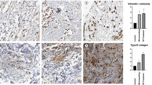 Immunohistochemical analyses of radiofrequency of the samples treated with radiofrequency and microneedling.