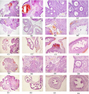 HE staining of ovarian tissue sections of rats in each group. A1–A4 represent the MT group; B1–B4 represent the RAPA group; C1–C4 represent the 3-MA groups; D1–D4 represent the model groups; E1–E4 represent the control groups; Nos. 1–4 correspond to magnifications of 4 ×, 10 ×, 20 ×, and 40 ×, respectively.