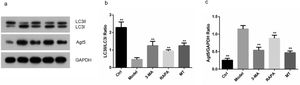 Effect of MT on the expression of autophagy-related proteins. (a) The expression of autophagy-associated proteins, LC3II/I and Agt5, was determined in ovarian granulosa cells by immunoblotting. (b‒c) The expression levels of autophagy-related proteins, LC3II/I and Agt5, were determined by ImageJ software (the experiments were independently performed three times).