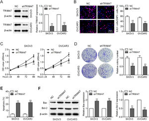 Knockdown of TRIM47 suppressed proliferation and increased apoptosis in ovarian cancer cells. (A) SKOV3 and OVCAR3 cells were transduced with lentivirus expressing shRNA against TRIM47 (shTRIM47) or Negative Control (NC); TRIM47 protein expression was analyzed by western blotting. (B) Fluorescence microscopy images (left) and quantification (right) of EdU-positive cells in the infected SKOV3 and OVCAR3 cells. Scale bar: 50 μm. (C) Cell viability was examined in the infected cells by CCK-8 assay. (D) Low-magnification images (left) and quantification (right) of SKOV3 and OVCAR3 cell colony formation. (E) Annexin V/propidium iodide double-staining flow cytometry was performed to determine cell apoptosis. (F) Western blots (left) were quantified to determine the levels of the apoptosis markers Bax (middle) and Bcl-2 (right) in the infected cells. ⁎⁎p < 0.01.