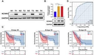 KCNK9 expression was upregulated in colon cancer and was associated with patients’ survival. (A) KCNK9 was overexpressed in tumor tissues than in normal tissues. (B) The mRNA and protein levels of KCNK9 in colon cancer cell lines (HT-29 and SW480) and the normal colon epithelial cell line (FHC) were examined by RT-qPCR and Western blotting. KCNK9 was overexpressed in colon cancer cell lines (p < 0.001); data were presented as mean ± Standard Deviation (SD); p-values were calculated using the Student's t-test. (C) Kaplan-Meier method was used to evaluate the overall survival in TCGA COAD according to KCNK9 expression level; (D) ROC curve of KCNK9 in TCGA COAD.