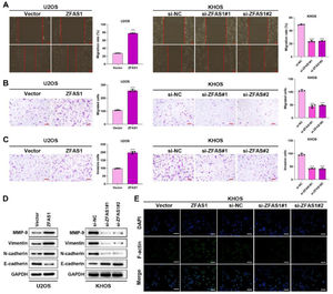 Lnc-ZFAS1 facilitates migration, invasion and EMT in osteosarcoma cells. Wound healing (A) and transwell (B and C) assays were adopted to examine the migratory and invasive capacities. (D) Western blotting was performed for the expression of EMT-related proteins. (E) F-actin was detected using Immunofluorescence staining (**p < 0.01).