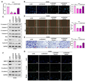 Lnc-ZFAS1 facilitates osteosarcoma progression via RHOC. To verify whether Lnc-ZFAS1 acts oncogenic driver in osteosarcoma progression in a RHOC-dependent manner, KHOS cells were transfected with Lnc-ZFAS1 siRNA and RHOC overexpression plasmids, qRT-PCR (A) was performed to detect the transfection efficacy. (B) EdU was performed for proliferation analysis. (C) Apoptosis-related proteins were detected by western blotting. Migration and invasion were evaluated by wound healing (D) and transwell (E). EMT-related proteins were measured by western blotting (F). (G) F-actin was examined using Immunofluorescence staining (*p < 0.05).