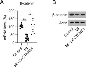 Expression of β-catenin in an MI rat model. A rat model of MI was established via the ligation of the LAD coronary artery, with or without LV-CTNNB1 transduction. (A) qPCR and (B) WB analysis of β-catenin mRNA and protein expression levels in the cardiac tissue from each group. LAD, Left Anterior Descending; LV, Lentiviral; MI, Myocardial Infarction; qPCR, quantitative PCR; WB, Western Blot.