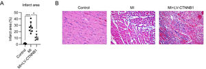 Effect of β-catenin upregulation on infarct size and pathological changes in the cardiac tissue of MI rats. A rat model of MI was established via the ligation of the LAD coronary artery, with or without LV-CTNNB1 transduction. (A) TTC staining of cardiac tissues from each group. The right panel shows the quantification of the infarct area. (B) Pathological changes in cardiac tissues were examined using H&E staining. H&E, Hematoxylin and Eosin; LAD, Left Anterior Descending; LV, Lentiviral; MI, Myocardial Infarction; TTC, Triphenyl Tetrazolium Chloride.