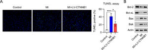 β-catenin upregulation reduced apoptosis in the cardiac tissue of MI rats. A rat model of MI was established via the ligation of the LAD coronary artery, with or without LV-CTNNB1 transduction. TUNEL staining was used to analyze apoptotic cells in the cardiac tissue of MI rats. LAD, Left Anterior Descending; LV, Lentiviral; MI, Myocardial Infarction; TUNEL, Terminal Deoxynucleotidyl Transferase-Mediated dUTP Nick-End Labeling; WB, Western Blot.