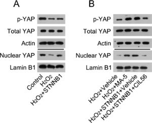 β-catenin reactivated YAP in the cardiac tissues of MI rats and H2O2-treated cardiomyocytes. (A) Cardiomyocytes were first transfected with pcDNA3.1-CTNNB1 for 24h, and then treated with 100 μM H2O2 for over 12h. Levels of total YAP, phosphorylated YAP, and nuclear-localized YAP in cardiomyocytes was analyzed by WB. (B) Cardiomyocytes were treated with 5 μM MA-5 for 12h and then treated with 100 μM H2O2 for over 12h. Cardiomyocytes transfected with pcDNA3.1-CTNNB1 were treated with 3.3 μM CIL56 for 12h and then treated with 100 μM H2O2 for over 12h. Levels of total YAP, phosphorylated YAP, and nuclear-localized YAP were analyzed by western blot. LAD, Left Anterior Descending; LV, Lentiviral; MA-5, Mitochonic Acid-5; MI, Myocardial Infarction; WB, Western Blot; YAP, Yes-Associated Protein.