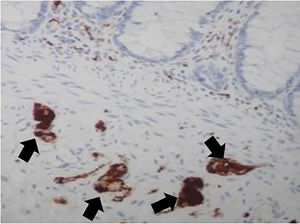 Calretinin labeling ganglion cells in submucosal plexus (400× magnification).