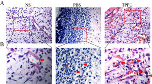 TPPU reducing inflammatory cell infiltration in the oral ulcer area. (A) Representative histological images of tissue from oral ulcer area in TPPU-Treated groups (TPPU) and PBS-Treated groups (PBS), the labial mucosa of the lower incisor alveolar bone from normal SD rats without any treatment (NS) was used as blank control. scale bar = 20 µm. (B) Magnified images of boxed areas in (A) showing the infiltrated inflammatory cells (red arrowhead) and angiogenesis (red arrow). scale bar = 10 µm.