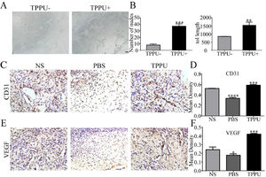 TPPU promoting tube forming and angiogenesis. (A) In vitro HUVECs (pretreated with/without TPPU) tube formation assay, scale bar = 200 μm. (B) Quantification of cumulative tube length and nodes for tube formation. (C) Immunohistochemical staining showing the CD31 expression in NS, TPPU-treated and PBS-treated groups, respectively, scale bar = 20 μm. (D) Quantification of CD31 expression. (E) Immunohistochemical staining showing the VEGF expression in NS, TPPU-treated and PBS-treated group, respectively, scale bar = 20 μm. (F) Quantification of VEGF expression. NS, normal SD rat without any treatment. * p < 0.05, ** p < 0.01, *** p < 0.001, **** p < 0.0001.