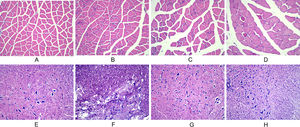 Observation of morphological changes of gastrocnemius muscle and spinal cord histology after spinal cord injury in rats using, HE staining. (A‒D) The morphological changes of gastrocnemius muscle in each group at 28 d after injury (A: normal group; B: sham-operated group; C: model group; D: training group). (E‒H) The morphological changes of spinal cord tissue in each group at 28 d after injury (E: normal group; F: sham-operated group; G: model group; H: training group).