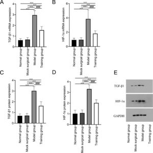 Expression of TGF-β1 and HIF-1α in spinal cord tissue after spinal cord injury in rats. Fig. 3 shows that exercise training significantly reduced the expression of mRNA (A‒B) and protein (C‒D) of TGF-β1 and HIF-1α in spinal cord tissue after spinal cord injury. (E) shows the Western blot band images of TGF-β1 and HIF-1α protein expression. Note: Compared with the normal and sham-operated groups, ⁎⁎⁎p < 0.001; compared with model group, ###p < 0.001.