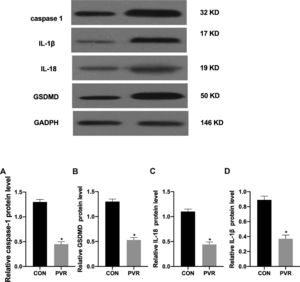 Expression of pyroptosis-related proteins in PVR patients. The expression of (A) caspase-1, (B) IL-1β, (C) IL-18, and (D) GSDMD proteins in the retinal proliferative membrane tissue samples analyzed by western blotting. *p < 0.05, compared with the control group. PVR, Proliferative Vitreoretinopathy; caspase-1, Cysteinyl aspartate specific proteinase; IL-1β, Interleukin-1β; IL-18, Interleukin-18.