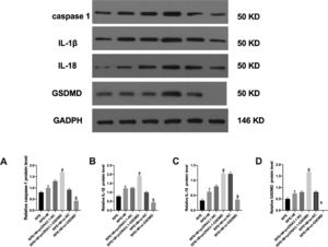 Expression of pyroptosis-related proteins in each cell group. The expression of (A) caspase-1, (B) IL-1β, (C) IL-18, and (D) GSDMD proteins in each group of cells analyzed by western blotting. *p < 0.05, compared with the control group. PVR, Proliferative Vitreoretinopathy; caspase-1, Cysteinyl aspartate specific proteinase; IL-1β, Interleukin-1β; IL-18, Interleukin-18.