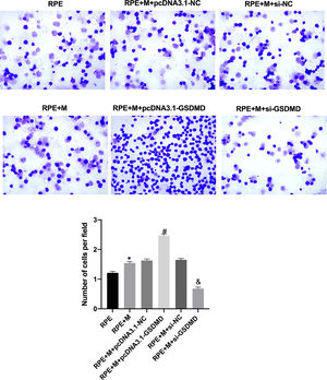 Müller cell pyroptosis enhances ARPE-19 cell adhesion. The adhesion of ARPE-19 cells in each group was analyzed using cell adhesion experiments. *p < 0.05 compared with RPE+M; #p < 0.05, compared with RPE+M+pcDNA3.1; and &p < 0.05, compared with RPE+M+si-NC. RPE: RPE cell-only culture group; RPE+M: RPE and Müller cell co-culture group; RPE+M+pcDNA3.1-NC: RPE and empty plasmid Müller cell co-culture group; RPE+M+pcDNA3.1-GSDMD: RPE and pyroptosis-related protein-overexpressing Müller cell co-culture group; RPE+M+si-NC: RPE and negative control siRNA Müller cell co-culture group; RPE+M+si-GSDMD: RPE and Müller cells treated with siRNA to inhibit the expression of pyroptosis-related proteins; siRNA, Small Interfering RNA.