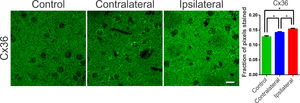 Typical photomicrographs of Connexin 36 (Cx36) immureactivity in the striatum regions of the groups submitted to the 6-OHDA injection (Injured and contralateral area) and in the Control group. Note the Cx36 stainning with a immunoreactive puncta throughout the region of dendritic fibers and around the cell body of striatal neurons. The lesional region showed more intense immunoreactivity along its entire length, with zones of greater intensity around the cell body of the cells observed. The contralateral region also showed an increase in the staining intensity, mainly perisomatic, when compared to the control sections. The monofactorial analysis of variance of the optical densitometry data confirmed this significant increase in the intensity of Cx36 staining in the lesional region and in the contralateral striatal region, in relation to the control group. White bar indicates 10 µm. * Indicates p < 0.05.