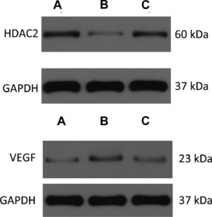 Expression of HDAC2 and VEGF in the lung tissue. (A) Control group; (B) COPD group; (C) Atorvastatin group.