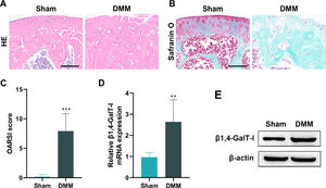 Expression of β1,4-GalT-I is elevated in the articular cartilage of DMM-induced OA mice. The mice were randomly assigned to a DMM group and a Sham group, with six mice in each group. (A and B) Representative images of articular cartilage stained with H&E (A) and safranin O-fast green (B) (scale bar: 100 μm). (C) OARSI score of the joints. (D and E) The qPCR and western blot were used to detect mRNA and protein expression of β1,4-GalT-I in articular cartilage (*** p < 0.001, ** p < 0.01).