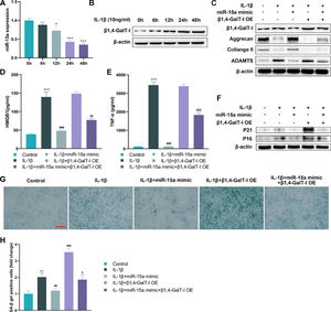 MiR-15a alleviated ECM degradation and cellular senescence in chondrocytes by suppressing β1,4-GalT-I. To mimic chondrocytes in OA, the authors stimulated human chondrocytes in vitro with IL-1 (10 ng/mL). The effects of miR-15a and β1,4-GalT-I on extracellular matrix degradation and senescence in chondrocytes was investigated. Chondrocytes in vitro were divided into five groups: IL-1β stimulation group, miR-15a mimic + IL-1β group, β1,4-GalT-I overexpression (OE) + IL-1β group, miR-15a mimic + β1,4-GalT-I OE + IL-1β group, and control group. (A and B) The authors observed changes in the expression of miR-15a and β1,4-GalT-I at different stimulation times (0h, 6h, 12h, 24h, and 48h) by qPCR or western blot, respectively (as compared to 0h, * p < 0.05, *** p < 0.001). (C) Western blot was used to detect the protein expression of β1,4-GalT-I, aggrecan, Collange II and ADAMTS5. (D‒E) The Senescence-Associated Secretory Phenotype (SASP), Tumor Necrosis Factor-alpha (TNF-α) and High Mobility Group Box 1 (HMGB1) were detected using ELISA (*** p < 0.001, as compared to control group; ### p < 0.001, as compared to IL-1β group; $$ p < 0.01, $$$ p < 0.001, as compared to IL-1β group). (F) Senescence-related markers (P21 and P16) were detected by western blot. (G‒H) The SA-β-Gal staining of chondrocytes (Scale bar: 100 μm) (** p < 0.01, as compared with control group; ## p < 0.01, ### p < 0.001, as compared with IL-1β group; $ p < 0.05, as compared with IL-1β + miR-15a mimic group).