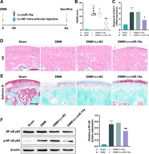 Intra-Articular Injection (IAJ) of miR-15a ameliorates cartilage degeneration by inhibiting β1,4-GalT-I/NF-Κb. (A) Experimental layout to observe the effect of miR-15a on cartilage degeneration in vivo. Mice were divided into the Sham, DMM, DMM + Lv-NC, and DMM + Lv-miR-15a groups. The authors established DMM-induced OA mice by microsurgery and administered intra-articular injections of Lv-miR-15a once daily for 7 weeks, one week after surgery. (B) OARSI scores of the joints in each group. (C) The mRNA expression of β1,4-GalT-I in articular cartilage, which was detected by qPCR. (D and E) The H&E staining (D) and the safranin O-fast green staining (E) both showed that the articular cartilage in the knee of the mouse had undergone morphological changes (Scale bar = 100 μm). (F) The NF-κB p65 and p-NF-κB p65 expression in articular cartilage were detected by western blot (# p < 0.05, ### p < 0.001, as compared to DMM group; *** p < 0.001, as compared to Sham group).