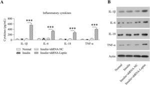 Influence of LEP silencing on inflammation in GCs treated with insulin. (A) ELISA was conducted for assessing the levels of interleukin-1β, interleukin-6, interleukin-18, and tumor necrosis factor-alpha in the culture supernatant of GCs treated with insulin. (B) WB was conducted for assessing the expression of interleukin-1β, interleukin-6, interleukin-18, and tumor necrosis factor-alpha in GCs treated with insulin (***p < 0.001).