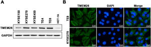 TMEM26 expression and cellular localization in various ESCC cell lines. (A) The abundance of TMEM26 in the normal esophageal epithelial cell line (HET-1A) and a collection of ESCC cell lines (KYSE150, KYSE270, KYSE450, TE4, and TE8) were examined by western blotting. (B) Immunofluorescent staining of TMEM26 with DAP in KYSE270 and TE8 cells verified the plasma membrane localization of TMEM26. Scale bar = 10 µm.