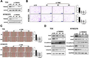 TMEM26 depletion in ESCC cells suppressed EMT-related alterations. (A) Transfection of siRNA targeting the TMEM26 gene (three independent targets) efficiently downregulated TMEM26 expression in TMEM26-high KYSE270 and TE8 cells, as detected in western blotting. (B) Transwell assay revealed a reduced number of invaded cells with TMEM26 RNAi, compared with control RNAi, in TMEM26-high KYSE270, and TE8 cells. Left: representative images. Right: quantification and statistical result. Scale bar = 100 µm. (C) Wound healing assay for TMEM26 RNAi KYSE270 and TE8 cells showed fewer cells migrating into the wound region, compared with control RNAi cells. Left: representative images. Right: quantification and statistical result. Scale bar = 100 µm. (D) Western blotting to detect mesenchymal and epithelial marker expressions showed downregulated twist, snail, N-cadherin, and vimentin but upregulated E-cadherin in TMEM26 RNAi KYSE270 and TE8 cells. Data are presented as means ± S.D., n = 3, ***p < 0.001.