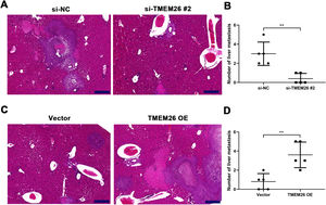 TMEM26 contributes to ESCC metastasis to the liver. (A) H&E staining showed a lower number of metastases and a reduced area of cancerous nests in the liver in the si-TMEM26#2 group. (B) H&E staining showed increased metastases and larger area of cancerous nests in the liver in the TMEM26 OE group. Data are presented as means ± S.D., n = 5, **p < 0.01.