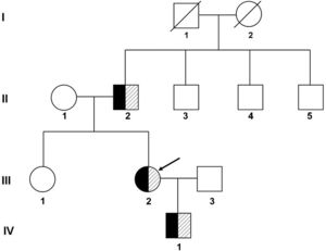 Pedigree of the family with long QT syndrome. I, II, III, and IV refer to the first, second, third, and fourth generations of the family, respectively. Black represents clinically diagnosed patients with Long QT syndrome, shadows represent carriers of pathogenic mutations, and the arrow indicates the proband.