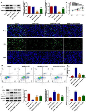 KIF22 knockdown suppressed proliferation and aggravated apoptosis of melanoma cells by inactivating EGFR/STAT3 signaling. (A) The expression of p-EGFR and p-STAT3 in KIF22-silenced A375 cells with or without EGF treatment was detected by western blot. ⁎⁎⁎ p < 0.001 vs. siRNA-NC; ### p < 0.001 vs. siRNA-KIF22. (B) CCK-8 assay was utilized to assess the viability of KIF22-silenced A375 cells with or without EGF/Colivelin treatment. (C) EDU staining was used to evaluate the proliferation of KIF22-silenced A375 cells with or without EGF/Colivelin treatment. (D) The apoptosis of KIF22-silenced A375 cells with or without EGF/Colivelin treatment was tested by using flow cytometry assay. (E) Quantification of apoptosis was detected by flow cytometry assay. (F) The expression of apoptosis-related proteins in KIF22-silenced A375 cells with or without EGF/Colivelin treatment was detected by western blot. ⁎⁎⁎ p < 0.001 vs. control; ## p < 0.01, ### p < 0.001 vs. siRNA-KIF22.