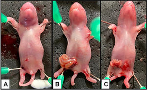 Represents the macroscopic view of gastrochisis at different gestational ages. (A) Neonate control; (B) Neonate with GS 18 shows the intestinal loops with edema and inflammatory aspect and (C) Neonate with GS 19 shows less edema and a decrease of inflammatory.