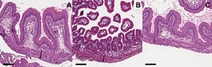 Represents the histological findings of the gastroschisis villus indifferent gestational ages. Cross sections of intestinal villi obtained from GS 18 (A), GS 19 (B) and Controls (C). Note the increased thickness of the muscle layer of the bowel of the fetuses with gastroschisis. Scale bar = 100 µm.